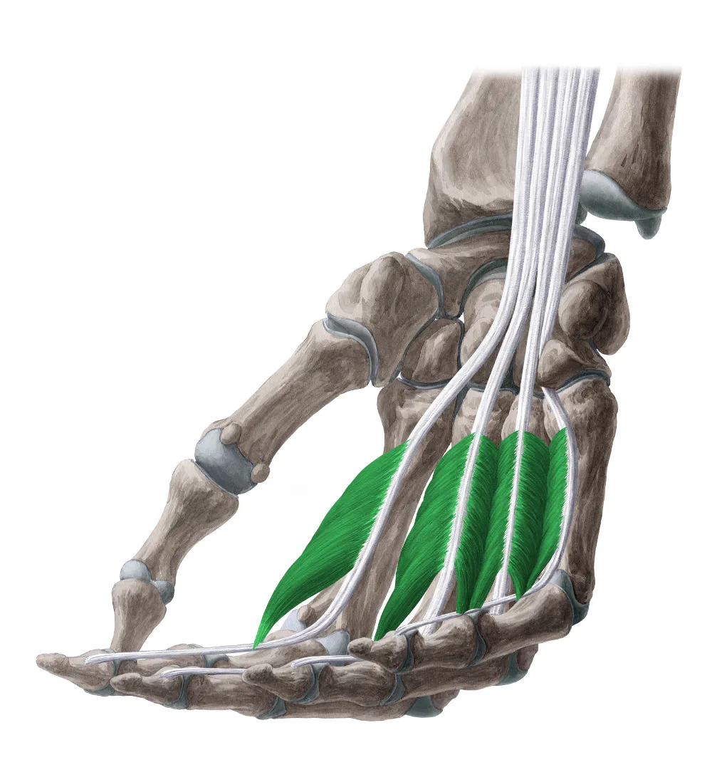 Anatomical illustration of the lumbrical muscles of the hand, highlighted along the fingers.